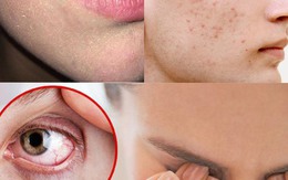 Dấu hiệu làn da thiếu vitamin và cách bổ sung