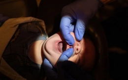 Góc khuất sau việc "cắt thắng lưỡi cho bé sơ sinh": Từ thủ thuật nhỏ giúp trẻ bú mẹ thành "món lợi" cho những người lợi dụng lòng tin