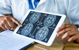 Căn bệnh khiến cô gái lúc nào cũng như say rượu