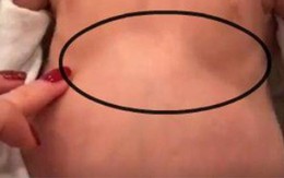 4 dấu hiệu cảnh báo suy hô hấp ở trẻ nhưng nhiều cha mẹ không hay biết