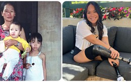 Cuộc sống hiện tại của bé gái gốc Việt bị mất 2 chân sau vụ tự sát bằng bom của bố mẹ: Được truyền thông thế giới gọi là 'nữ kình ngư thần kỳ'