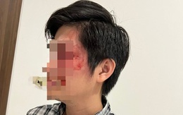 UBND TP.HCM yêu cầu xử lý nghiêm vụ chủ chó đánh cư dân nhập viện