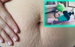 Sai lầm của chị em muốn phục hồi cơ bụng sau sinh để bụng phẳng, eo thon