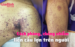 Cách phòng, chống nhiễm liên cầu lợn trên người