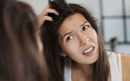 6 thói quen không ngờ gây rụng tóc
