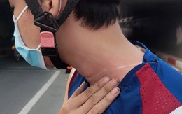 TP.HCM: Nhiều người bị dây diều cứa cổ, ngã chấn thương