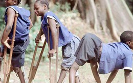 Lịch sử căn bệnh bại liệt hoang dại và cách tốt nhất để ngăn ngừa