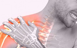 5 bài tập khắc phục cơn đau do viêm quanh khớp vai