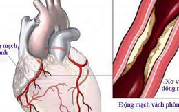 Đường ruột tác động đến sức khỏe tim mạch như thế nào?