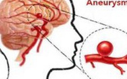 Phát hiện sớm phình động mạch não