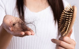 Ba thói quen ăn uống khiến tóc ngày càng rụng