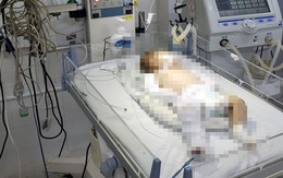 Tạm giữ nghi phạm bạo hành bé gái hơn 2 tháng tuổi chấn thương sọ não ở Đà Lạt