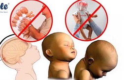 Rung lắc trẻ sơ sinh nguy hiểm thế nào? Những bệnh tiềm ẩn trẻ có thể mắc phải?