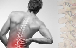 3 động tác tăng cường chức năng cột sống, cải thiện chứng đau lưng