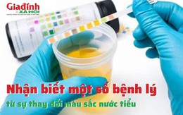 Nước tiểu biến sắc - cách nhận diện bệnh lý toàn thân hoặc tại chỗ ai cũng nên biết