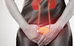 Biện pháp ngăn ngừa mất nước, phòng bệnh tiết niệu trong mùa hè
