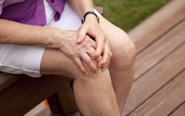 Thoái hóa khớp gối chữa thế nào để cải thiện cơn đau?