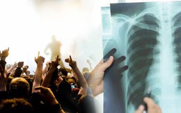 Thanh niên vỡ phế nang vì la hét trong concert của thần tượng: Nguyên nhân nào dẫn đến tràn khí màng phổi?