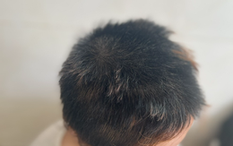 Vụ thiếu nữ 16 tuổi bị chủ spa hành hạ vì ghen tuông: Không dám ra đường!