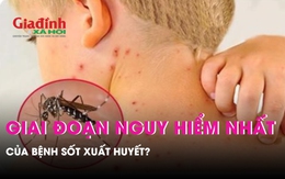 Các cấp độ của sốt xuất huyết: Giai đoạn nào nguy hiểm nhất?