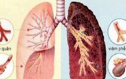 Dưỡng sinh và dùng thuốc nâng cao sức đề kháng, phòng bệnh trong mùa thu