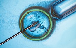 Chi tiền tỷ xuất ngoại để tiêm tế bào gốc, chuyên gia khuyến cáo gì?