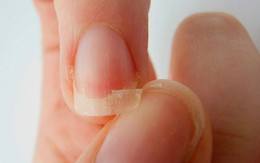 Sơn móng tay nhiều có gây hại không?