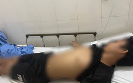 Bắc Kạn: Một bệnh nhân nghi phát bệnh dại sau 1 năm bị chó cắn