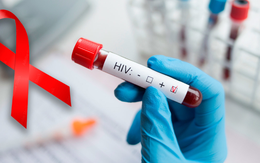 Những điều cần biết về xét nghiệm HIV trong thai kỳ