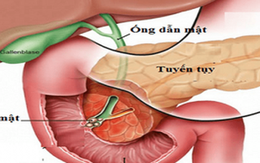 5 loại thực phẩm 'giết chết' tuyến tụy