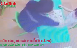 Bức xúc, bé gái 2 tuổi ở Hà Nội bị cô giáo đánh liên tiếp vào mặt trước đó đã có nhiều vết bầm quanh cổ