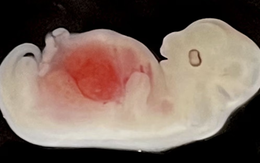 Tạo ra bộ phận cơ thể người đầu tiên trên thân động vật: Triển vọng và tranh cãi