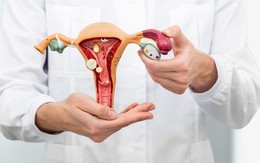 Polyp buồng tử cung gây ảnh hưởng khả năng sinh sản thế nào?
