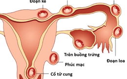 Khi thai nhi nằm sai vị trí