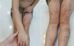 Tin sáng 11/10: Thông tin mới nhất vụ 6 trẻ mầm non bị đánh bầm tím; cảnh giác 'chiêu' mạo danh công an hỗ trợ lấy lại tiền bị lừa đảo