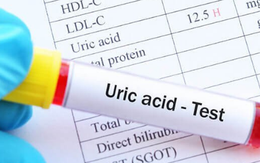 Ai có nguy cơ bị tăng acid uric máu?