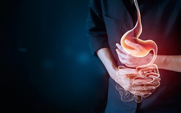 4 biện pháp giữ hệ tiêu hóa khỏe trong ngày Tết