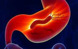 Vi khuẩn H.P gây viêm dạ dày lây qua đường nào?
