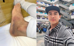 Nam ca sĩ Việt gặp vận xui ở trời Tây: Bị ngã trẹo chân, thất lạc vali nên gần 1 tuần không dám gội đầu