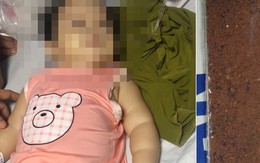 Quảng Bình: Bé gái 11 tháng tuổi ngộ độc chì do 'thuốc cam'