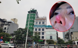 Thảm họa làm đẹp khi đến nhầm chỗ (bài 7): Hành trình 84 ngày của người phụ nữ 53 tuổi ở Hà Nội chống lại nỗi đau sau nâng mũi ở Viện Thẩm mỹ Quốc tế ChangWon