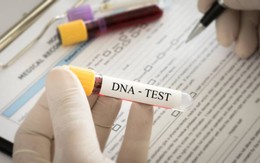 Tin sáng 23/5: Bất ngờ kết quả xét nghiệm ADN trong vụ bé gái 12 tuổi sinh con ở Hà Nội; tin mới nhất sức khoẻ nữ bác sĩ bị tấm kính rơi vào người