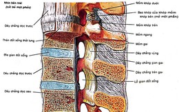 Các phương pháp trị thoát vị đĩa đệm