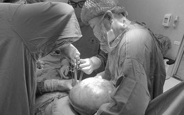 Nữ bệnh nhân 57 tuổi mang khối u buồng trứng nặng đến 7kg vì tâm lý chủ quan phụ nữ Việt hay mắc phải