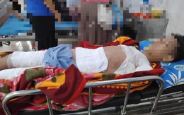 Nam sinh 11 tuổi ở Tuyên Quang phải đi cấp cứu với vết thương vùng kín nặng nề do tai nạn nhiều người không ngờ tới