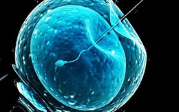 Sử dụng AI có thể giúp tăng tỷ lệ thành công của IVF