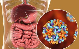 Cách cải thiện sức khỏe của gan