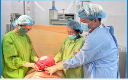 Người phụ nữ mang khối u xơ tử cung nặng 4,5kg vì sai lầm này trong suốt nhiều năm