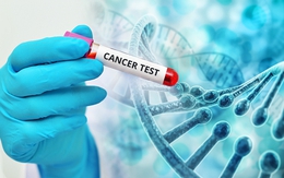 3 bước quan trọng trong khám tầm soát ung thư, ai cũng nên biết