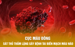 Cục máu đông – Sát thủ thầm lặng gây bệnh tai biến mạch máu não